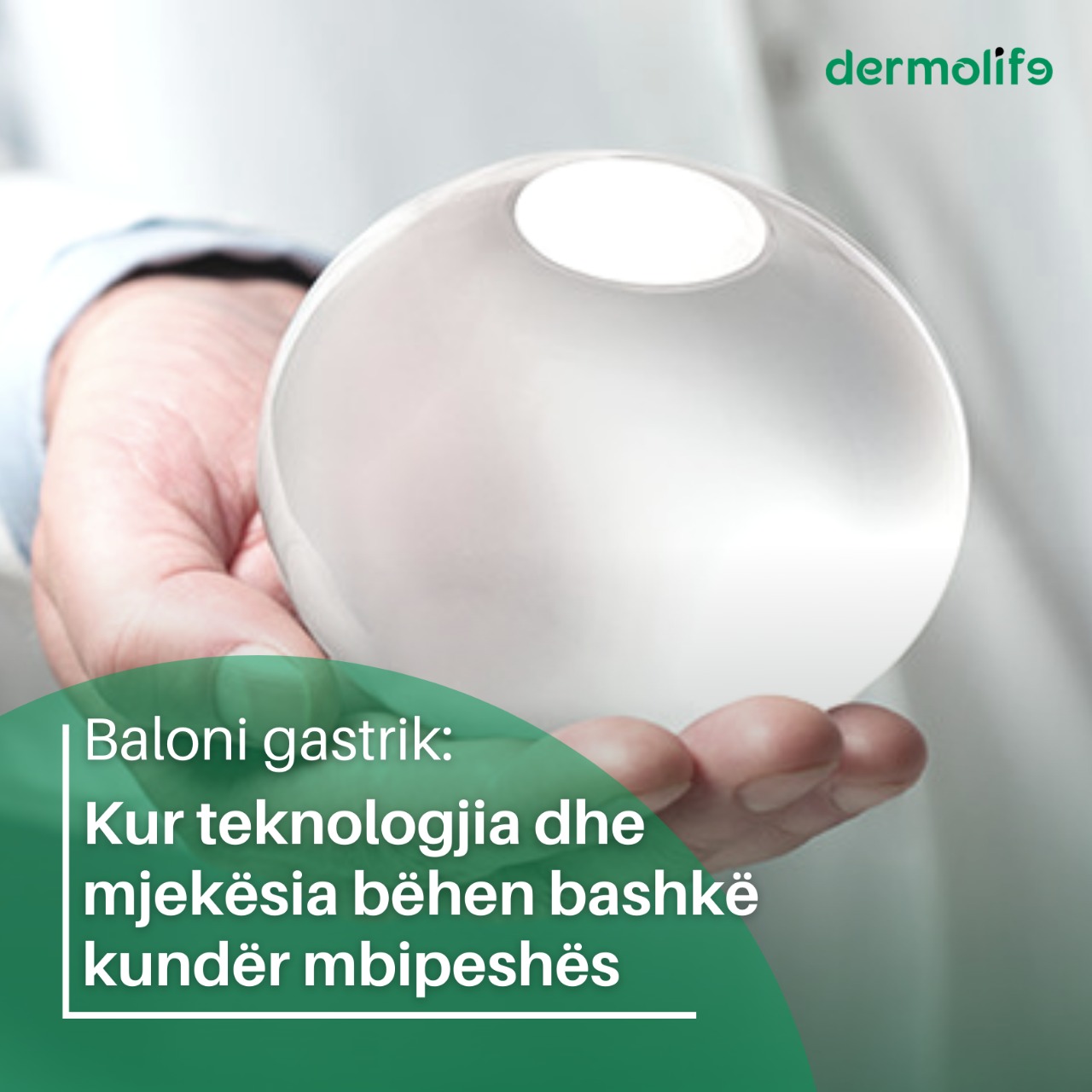 teknologjia e balonit gastrik